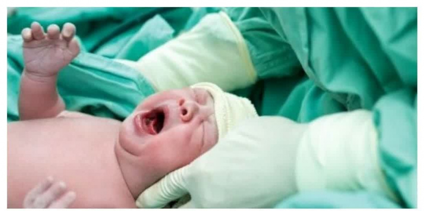 درخشش دانشگاه علوم پزشکی شاهرود در کاهش سزارین / تأکید بر توسعه زایمان بیدرد